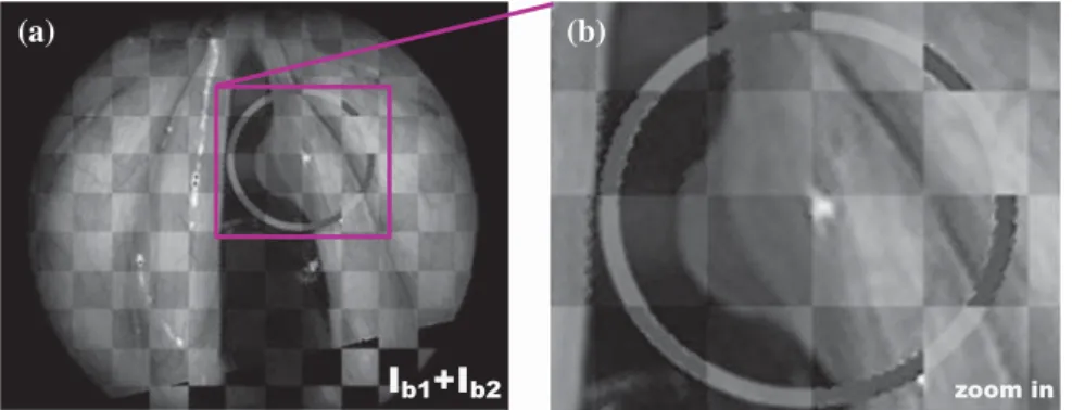 Fig. 9 Numerical registration results: a shows I b1 integrated in I b2 , and b a zoom in the region of interest