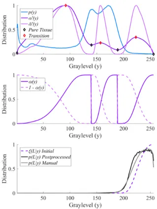 Fig. 2. Graylevel distributions for one FLAIR volume; top - histogram, edge distri- distri-bution, and extrema; middle - partial volume fraction from piecewise integration of the edge distribution; bottom - distributions of lesion: initial fuzzy estimate, 