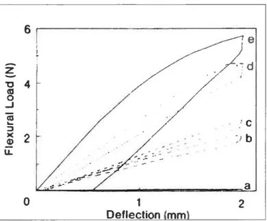 Figure 2.11 : Courbes force/déflection de différents fils orthodontiques : a) PMMA, b) Nickel-titane c) FRP (fraction volumique 29 %), d) FRP (60 %), e) Chrome-cobalt