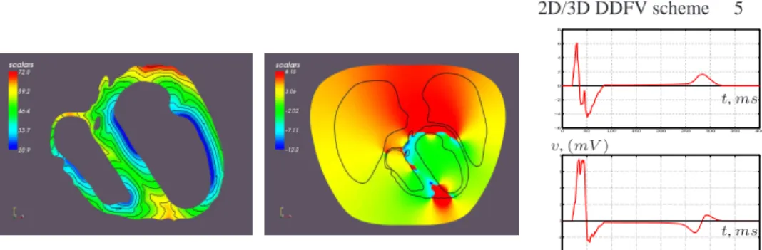 Figure 2. (left) Simulation of v : isochrons (ms )for the excitation wave on a 2D ven- ven-tricles slice mesh coming from MRI segmented images, 485000 degrees of freedom.