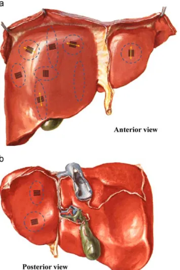 Fig. 12 – Location of sample harvesting for liver #3 anterior side (a) and posterior side (b), with the different samples shapes.