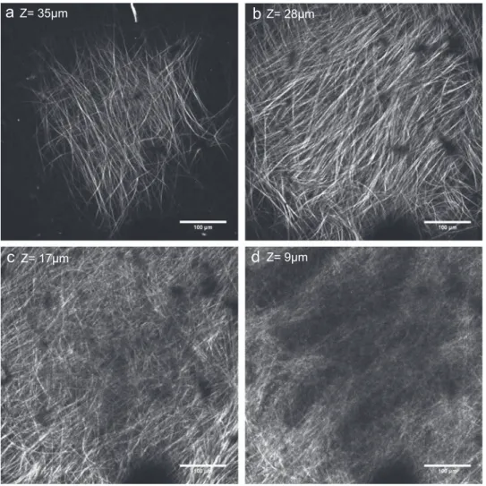 Fig. 7 – Variation along thickness of the organization of human liver capsule collagen ﬁ bers as seen on the SHG channel of the two photon excitation microscope