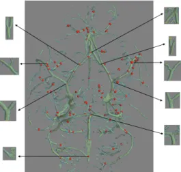 Figure 11: Centers of 3D bifurcations detected in a Micro-CT volume. 3D bifurcations associated to the Circle of Willis are enlarged.