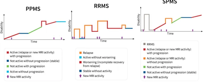 Figure 3.3: Graphics shows the kinds of disease activity that can occur in PPMS, RRMS and SPMS over time