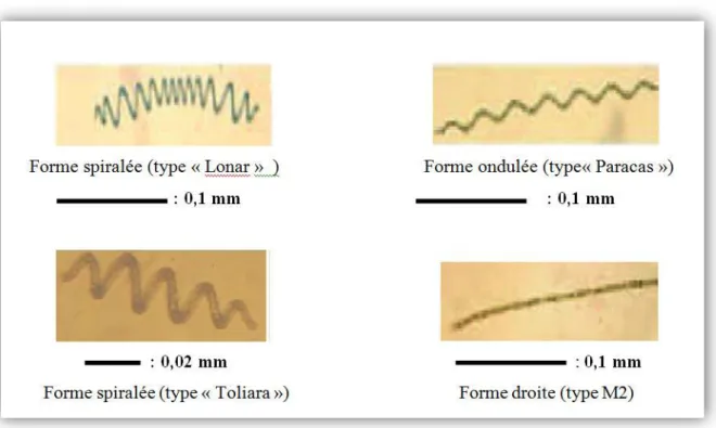 Figure Nº 03: Morphologies typiques de Spiruline (Source : Antenna Technologie).  