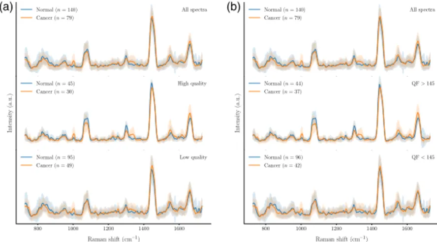 Fig. 2 ROC curves showing (a) the correspondence between the qualitative and quantitative spectral quality metrics and (b) the classification performance for different QF thresholds.