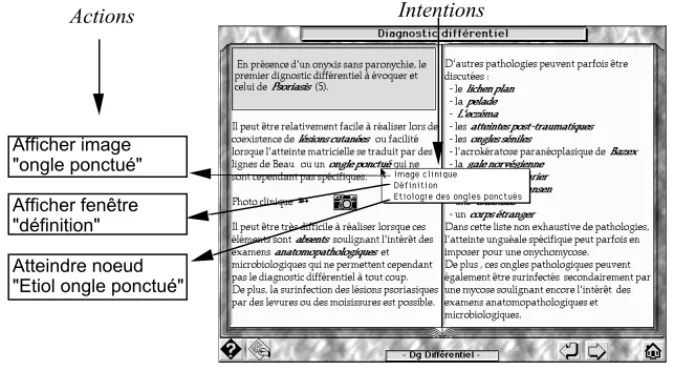 Figure 2 : Appel de l’hypermot « ongle ponctué » 2.2. Évolution dynamique