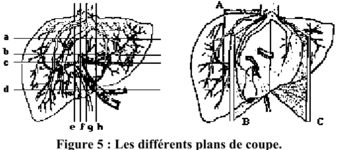 Figure 5 : Les différents plans de coupe.