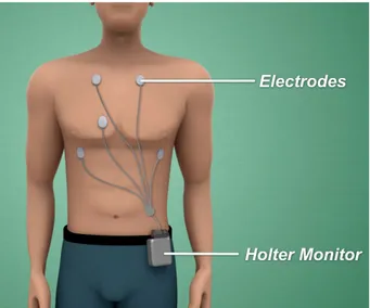 Figure 8: Holter ECG (SVH Heart Health, s.d.) 