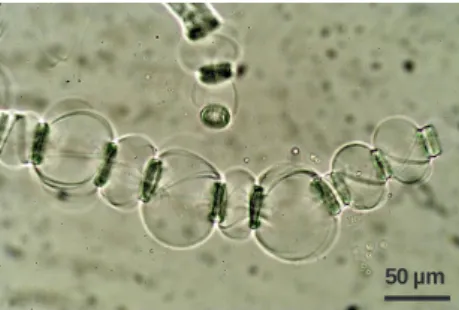 Figure 2. Wood fiber swollen by “ballooning” in NMMO – 20 % w/w water at 90 °C (magnification of 200 times)