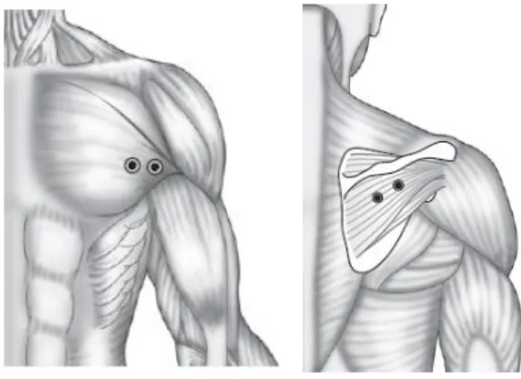 Figure 1. Positionnement du capteur  EMG no. 2 sur l’infraspinatus. [5] 