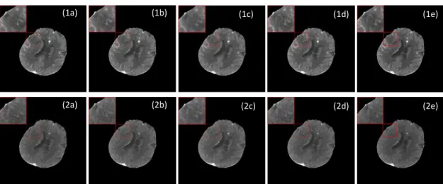 Fig. 4 The first row and second row are the 12 th  pass and 18 th  pass images of selected patient at slice  location 64