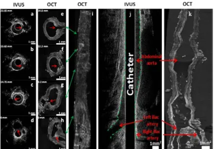 Figure 6. Intravascular ultrasound (IVUS) and OCT colocalization of anatomical landmarks in   model 2