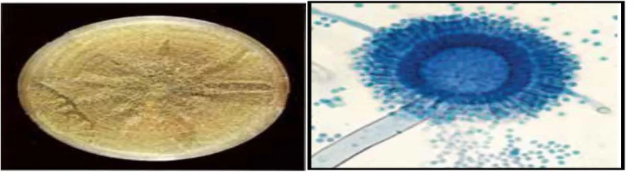 Figure 05 : Aspect micro et macroscopique d'Aspergillus flavus (TABUC ,2007).  