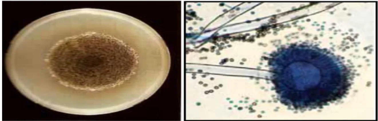 Figure 07 : Aspect micro et macroscopique d'Aspergillus niger (TABUC ,2007).  