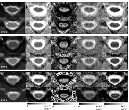 Fig 4 shows b = 0 images and FA maps obtained from analysis of the data acquired using the rFOV sequence at each site (averaged across subjects), after registration with the  MNI-Poly-AMU template