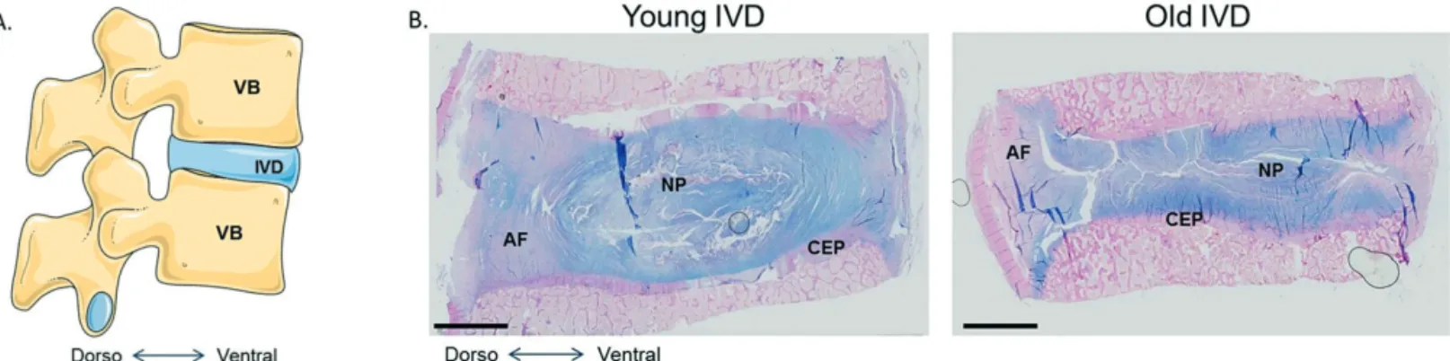 Figure 3. The human intervertebral disc. A. Schematic view of the human lumbar spine,  composed of vertebral bodies (VB) and intervertebral  discs (IVD)