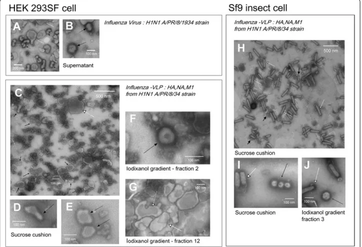 Figure 1 NSTEM images at 40,000× magnification of H1N1 A/Puerto Rico/8/34 (A &amp; B), H1N1 influenza-VLPs from HEK 293SF cell production (C-G) or Sf9 cell production (H-J)