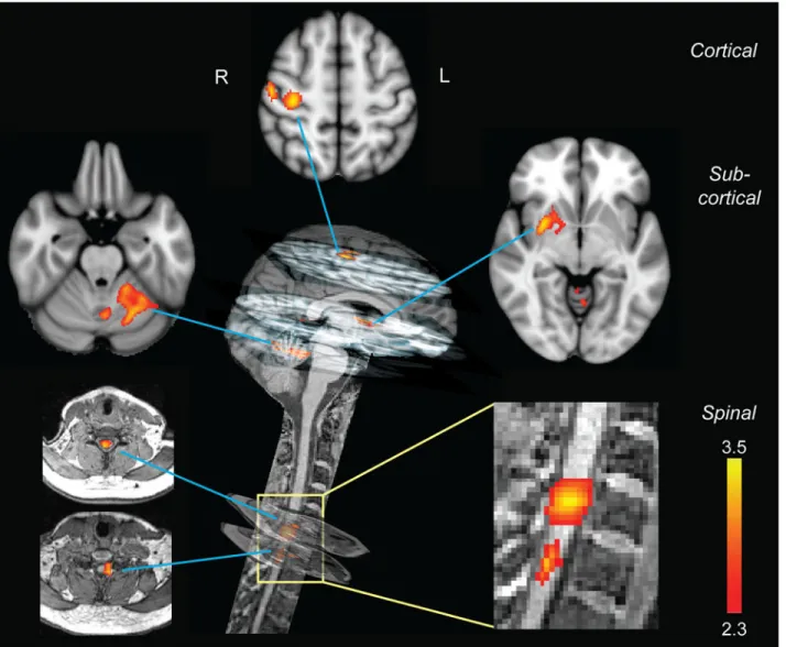 Fig 3. Neural correlates of motor sequence learning. Distinct cortical, subcortical, and spinal clusters showed learning-related modulation in activity only during the CS condition
