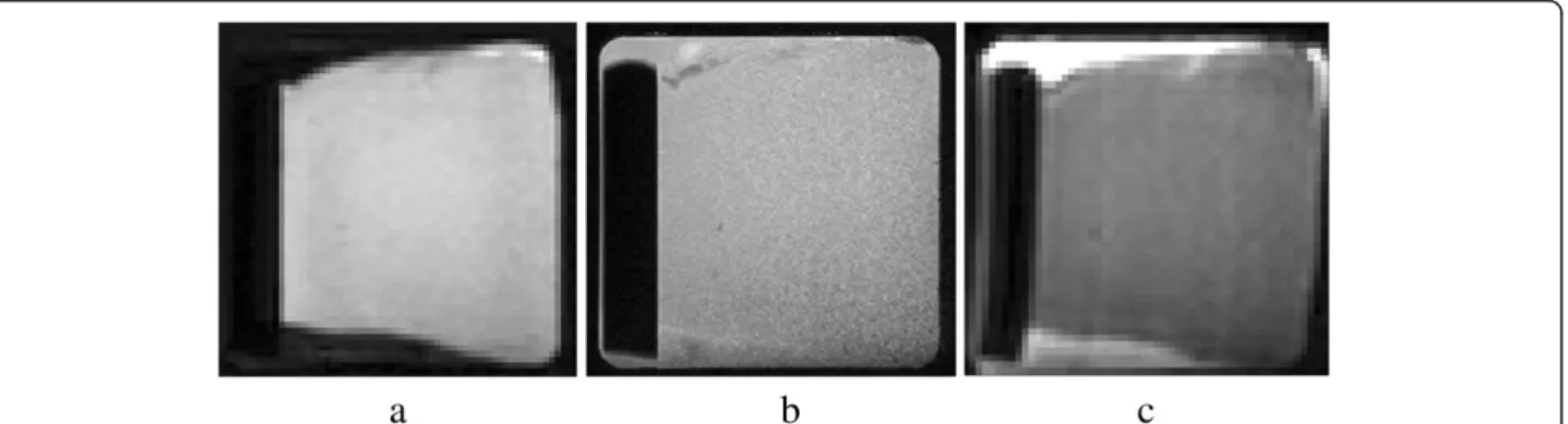 Figure 1 T1-weighted (a), T2-weighted (b) and diffusion weighted with a b-value of 1000 s/mm 2 (c) images of one cardiac tissue sample installed in the chamber manufactured in acrylonitrile butadiene styrene by fused plastic deposit.