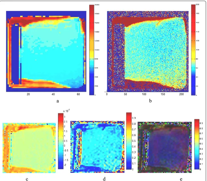 Figure 3 T1 in ms (a), T2 in ms (b), ADC in mm 2 /s (c), FA (d) and FA color (e) maps calculated from the T1- and T2-weighted images and from the diffusion tensor images of the sample shown in Figure 1