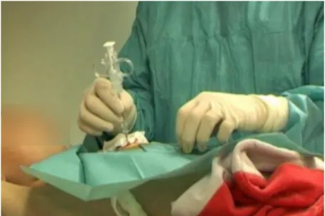 Fig. 1: Needle insertion in a biopsy procedure 