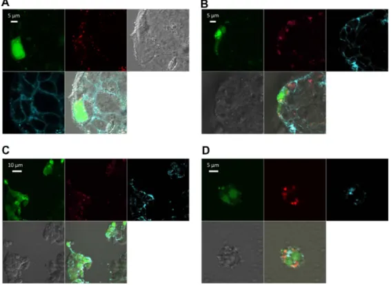 Figure 6 Confocal imaging of chitosan/dsODN nanocomplex uptake 24 hours post transfection