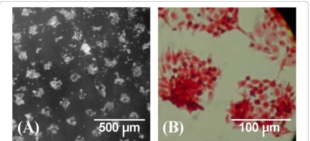 Figure 3 demonstrates that fetal bovine growth plate chondrocytes isolated without separating the different subpopulations, were enriched with terminally differentiated cells that are characterized by the expression of type X collagen (Day 0), a marker of 