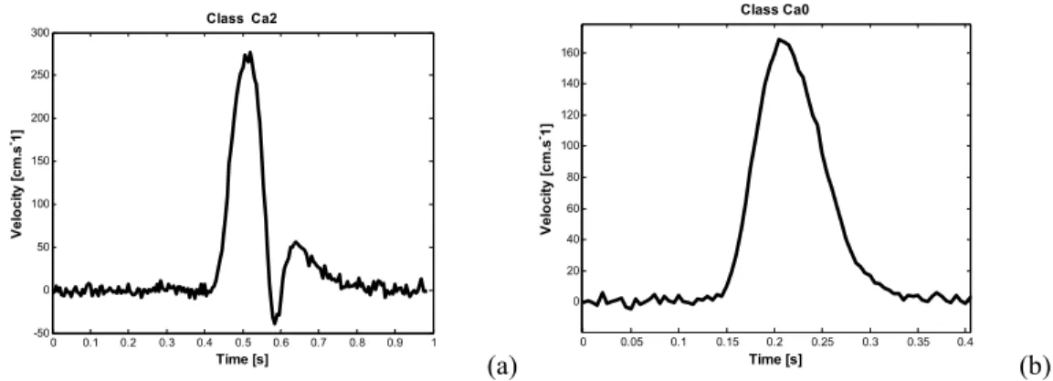 Fig 4. Two noisy Delta-Lognormal profiles that correspond to two of the ideal profiles depicted in Figure 3   (b) 