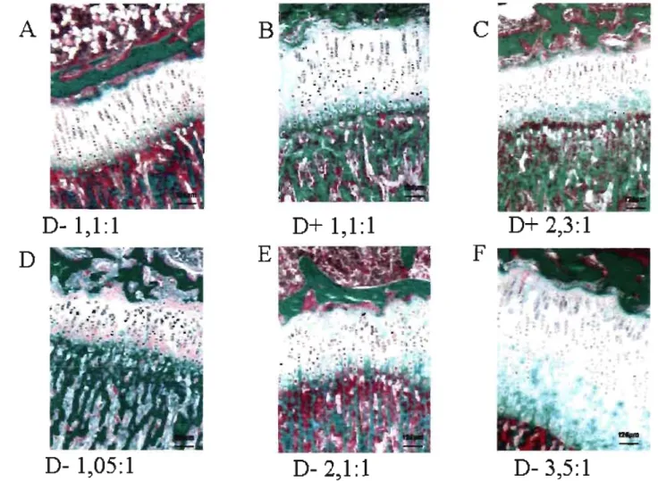Figure 6:  Histologie de cartilage de croissance de rats en function de la diète. A) Animaux carencés en vitamine D recevant un apport  faible  en Ca et en P, dont le ratio  1,1:1  B) Animaux réplété en vitamine D recevant un apport faible  en calcium et e