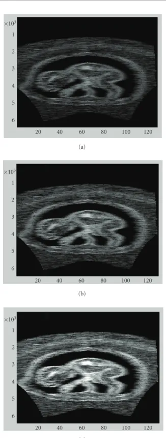 Figure 11: Images produced by ARM data using (a) 2 ADC channels, (b) 4 ADC channels, and (c) 8 ADC channels.