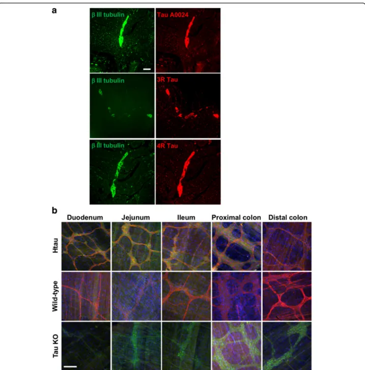 Fig. 4 Distribution and localization of tau in human, htau and wild-type mouse myenteric plexus