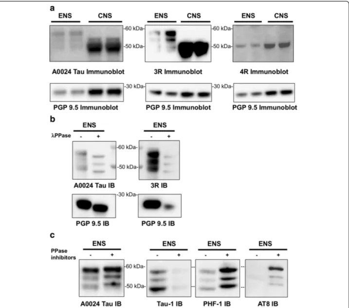 Fig. 7 Tau isoform profile and phosphorylation state in rat primary culture of ENS. a Lysates of rat primary ENS and CNS cultures were subjected to immunoblot analysis using the pan-Tau antibody A0024 and the isoform specific antibodies 3R and 4R