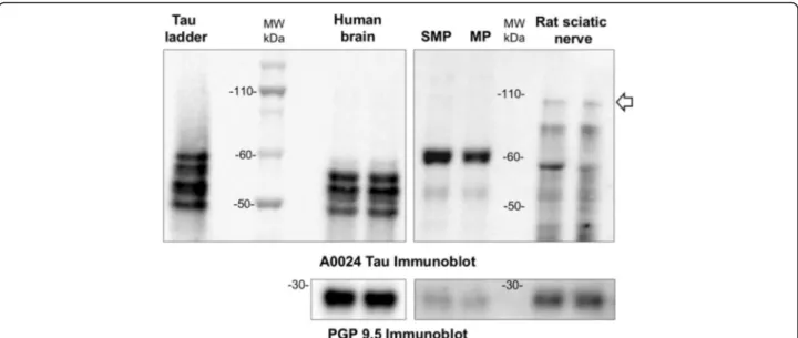 Fig. 2 Big tau is not detected in adult human ENS. Human brain and colon tissue lysates (SMP and MP) were subjected to immunoblot analysis using the pan-Tau antibody A0024