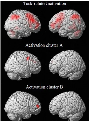 Figure 2 – Task related activation and location of activation clusters representing areas of  increased activation in relation to smaller hippocampal volume in MCI