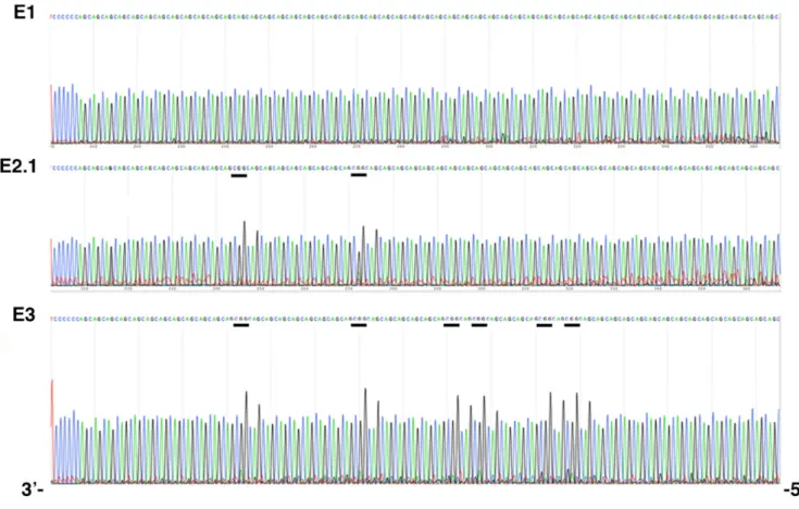 Figure 3. DM1 locus sequences in the family E (cloning sequencing). GGC (CCG) interruptions are underlined