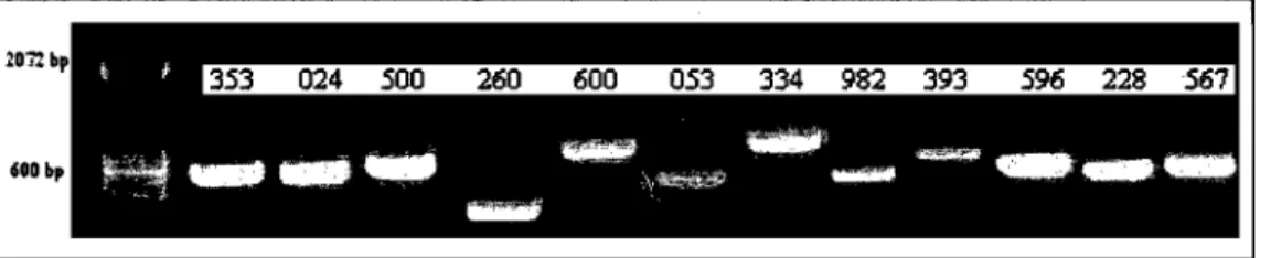 Figure  6.  Agarose  gel  showing  the  sequences  of candidate  genes  amplified  by  PCR  based  on  the  microarray  results