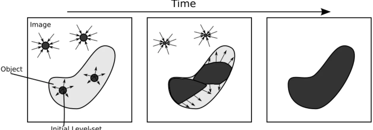 Figure 2: Segmentation process: a user-deﬁned level set is evolved based on image features.