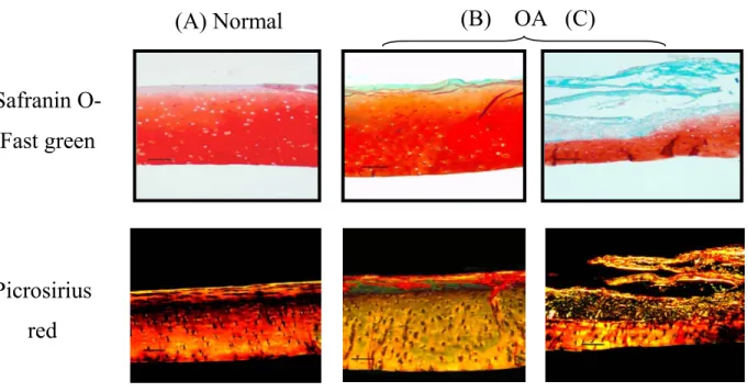 Figure 1.4 :   Coupes histologiques de  cartilage articulaire métacarpien  équin sain (A),  près d’une lésion (B) et dans la lésion (C) d’OA, colorées avec Safranine  O-Fast Green et Picrosirius red (image tirée de Vinardell et al., 2009)