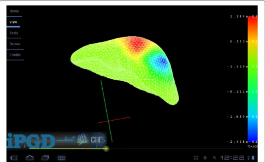 Figure 6 Implementation of the PGD approach to the liver palpation problem on a Motorola Xoom tablet