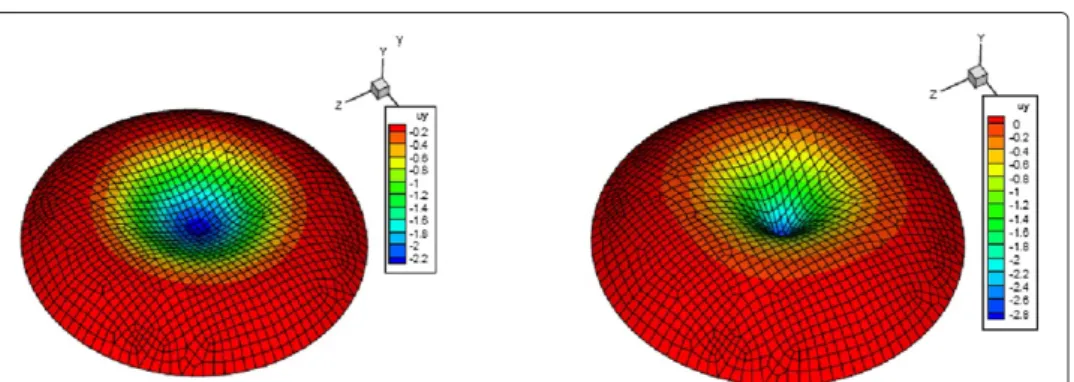 Figure 4 Vertical displacement field for a particular load position in the palpation of a cornea.