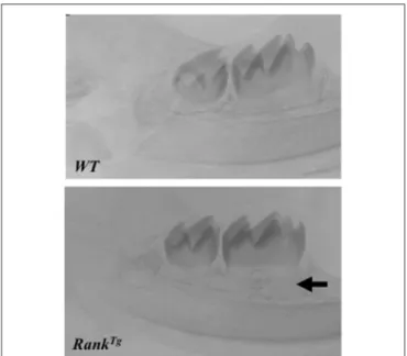 FIGURE 3 | Accelerated root elongation in RANK Tg mouse. Micro-CT section in the mandible main axis show in 11 day-old RANK Tg mouse a more advanced root elongation (arrow) compared to wild type mouse.