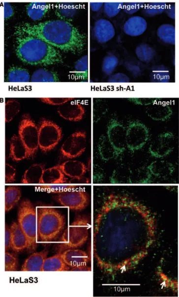 Figure 5. Angel1 co-localizes speciﬁcally with eIF4E in small peri- peri-nuclear granules