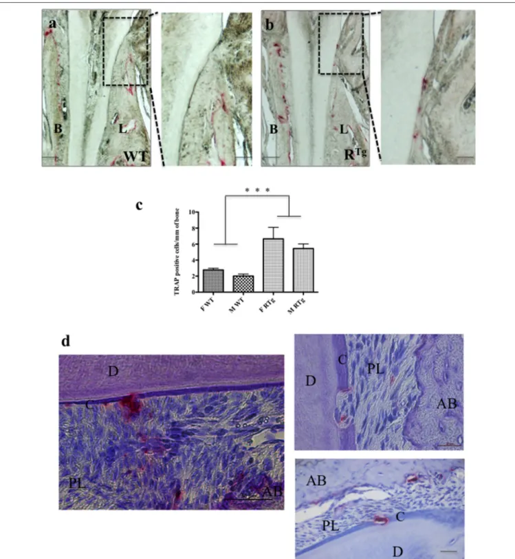 FIGURE 2 | TRAP positive cells in 5-month-old mice. TRAP histo-enzymology performed on frontal sections (a,b) enabled visualization of a large increase in the number of TRAP positive cells (red staining) on both buccal (B) and lingual (L) surfaces of the a