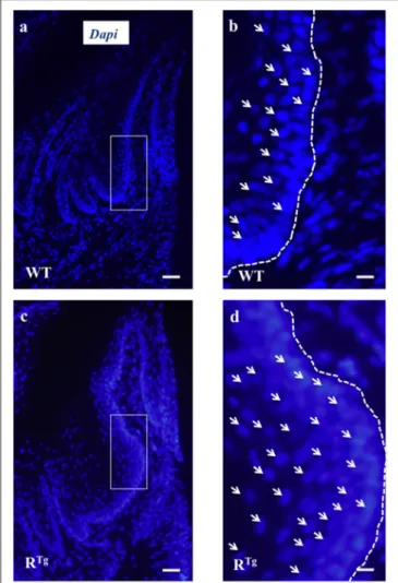 FIGURE 5 | Evidence of gingival epithelium hyper-cellularity in R Tg mice based on numbering of DAPI stained cell nucleus