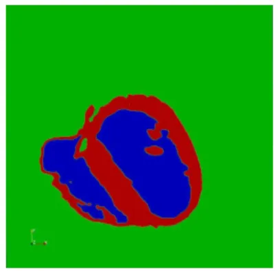 Figure 7: Meshes of a 2D thorax slice. 600 000 vertices in total, 500 000 in the ventricles