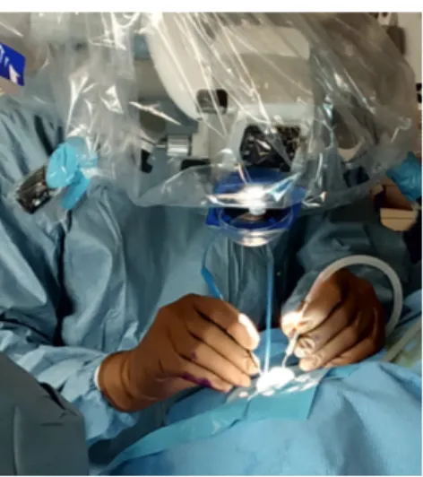 Figure 1: The comparison of the number of instruments possible to use simultaneously while using an endoscope and a microscope (Dr