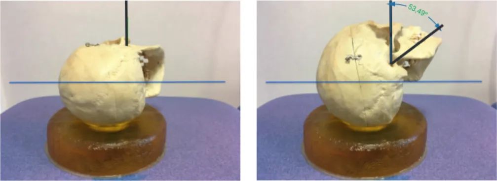 Figure 2: Placement of the ear in relation to the operating table in the optimal (right) and unfavourable (left) position