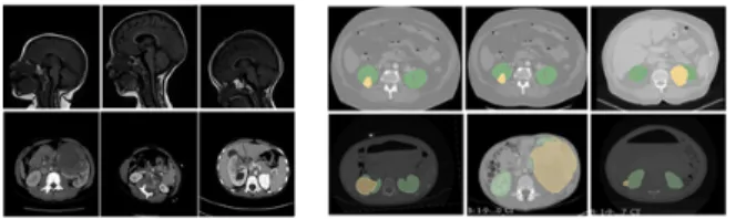 Fig. 1. Left: Differences in size and pose in two of our pediatric data- data-sets. First row: MR sagittal brain images