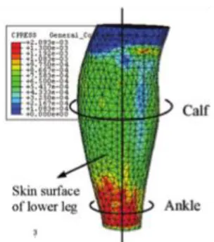 Figure 7: Skin pressure distribution obtained from a finite element simulation of a stocking being put on (X